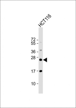 RAB8A Antibody