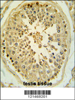 LMX1B Antibody (Center)