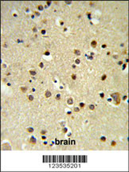 CBX1 Antibody (C-term)