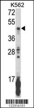 KIR2DL5B Antibody (Center)