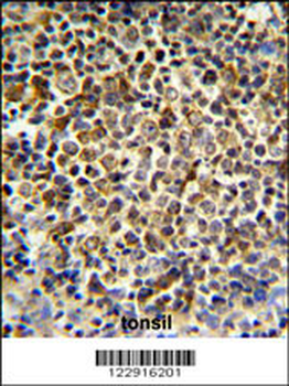 KIR2DL5B Antibody (Center)