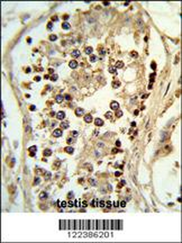 ABHD12 Antibody (N-term)