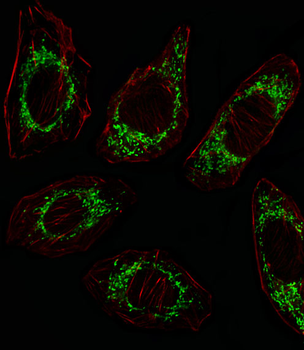 OAT Antibody (N-term)