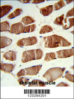 CSRP2BP Antibody (Center)