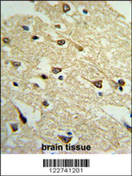 ADCY8 Antibody (Center)