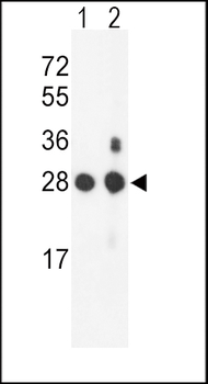 PSMB1 Antibody (C-term)