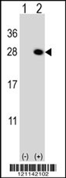 QDPR Antibody (C-term)