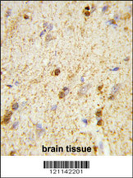 QDPR Antibody (C-term)