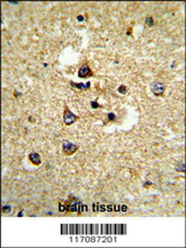 CYP7B1 Antibody (Center)