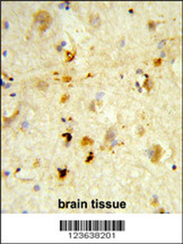 ITGBL1 Antibody (Center)