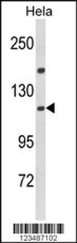 IPO11 Antibody (N-term)