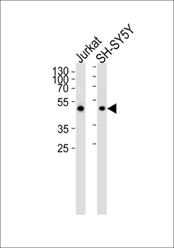 ANXA7 Antibody (Center)