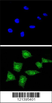 SOD1 Antibody (Center)