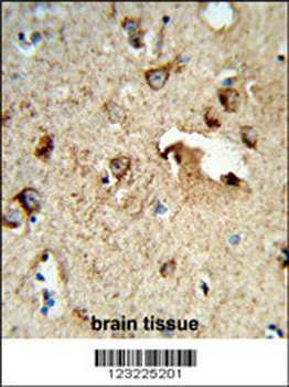 TSPAN1 Antibody (Center)