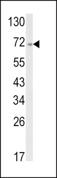 ATF6 Antibody (Center)