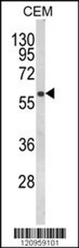FLCN Antibody (Center)