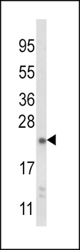 NQO2 Antibody (Center)