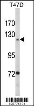 PTK2 Antibody (Center)