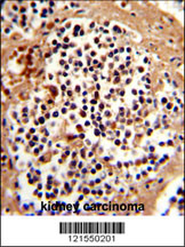 SERPINB7 Antibody (Center)