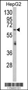 RARS2 Antibody (C-term)