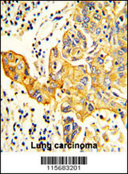 RARS2 Antibody (C-term)