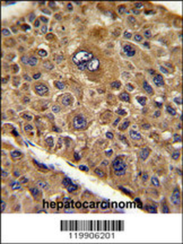 TOB1 Antibody (N-term)