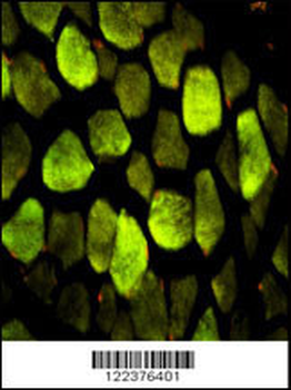 ATP5O Antibody (N-term)