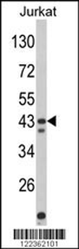 CECR5 Antibody (Center)