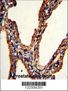 PSMB9 Antibody (C-term)