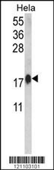 CALM1 Antibody (C-term)