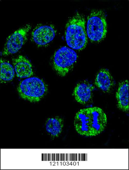 CALM1 Antibody (C-term)