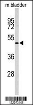 ACTR3B Antibody (C-term)
