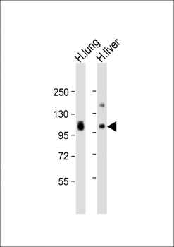 AOC3 Antibody (Center)