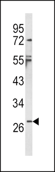 IL1B Antibody (Center)
