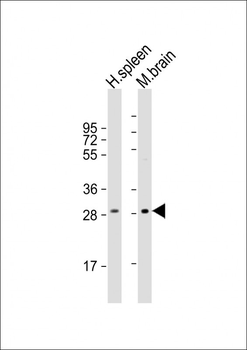 IL1B Antibody (Center)