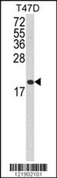 FAS Antibody (Center)