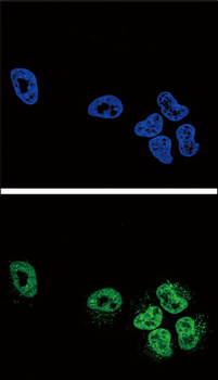 PLA2G4A Antibody (Center)