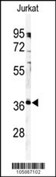PPP6C Antibody (C-term)