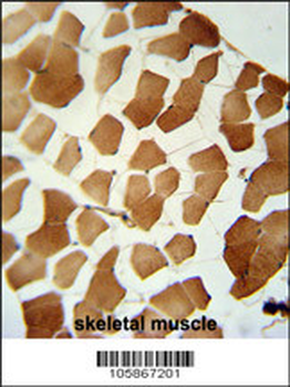 PPP6C Antibody (C-term)
