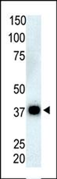PPP6C Antibody (N-term)