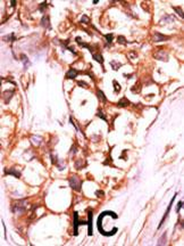 DUSP8 Antibody (C-term)