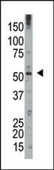 DUSP8 Antibody (N-term)