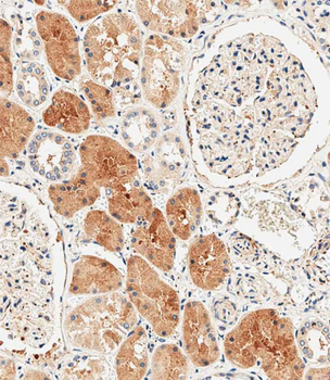 DUSP6 Antibody (Center)