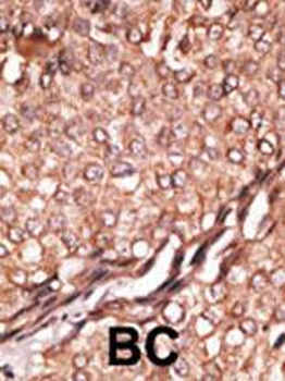 BAIAP2 Antibody (C-term)