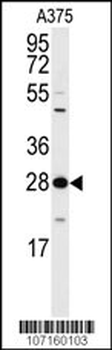 YWHAZ Antibody (T232)