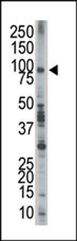 EPS8 Antibody (N-term)