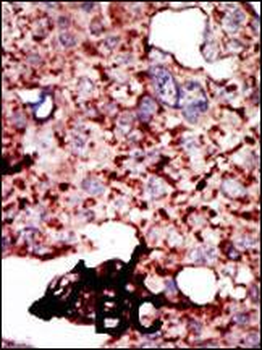 HK1 Antibody (C-term)