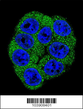 Fructose 6 Phosphate Kinase (PFKM) Antibody (C-term)