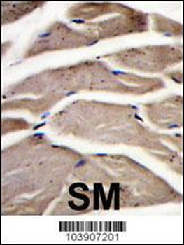 Fructose 6 Phosphate Kinase (PFKM) Antibody (C-term)