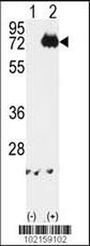 IKK alpha Antibody